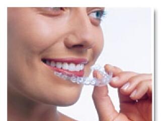 Fogszabályozás és esztétika