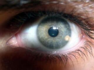 Szabaduljon meg a szúró, viszkető érzéstől!