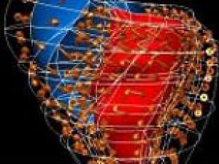 Infarktus és bejgli