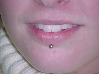 A szájpiercing veszélyei