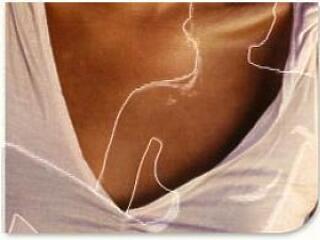 Amit a bőrrákról neked is tudnod kell!