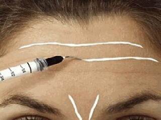 Veszélyes a ráncfeltöltés?