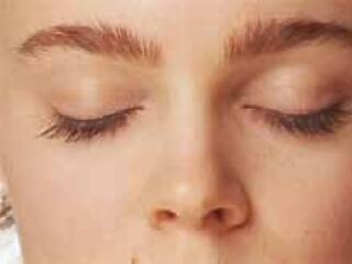 Gőzerővel legyőzheted a pattanásaidat!