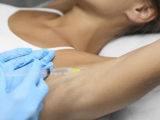 Megoldás az izzadásra: amit a botox kezelésről tudni kell