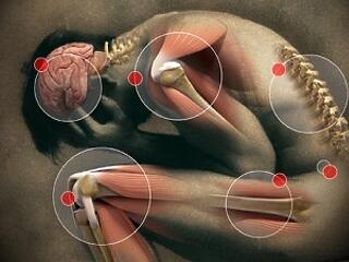 Az érszűkület komoly betegség! Vigyázzon vele!