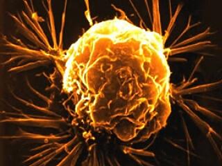 Csodaszer az emésztésnek! Megelőzheti a rákot!