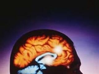 Mennyire képlékeny az emberi agy?