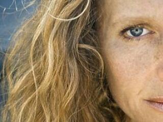 Nem ciki a pöttyös arc