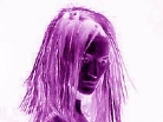 Az anorexiások egyre soványabbak