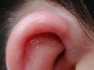 "Anyának háromszor nagyobbak lettek a fülei!"