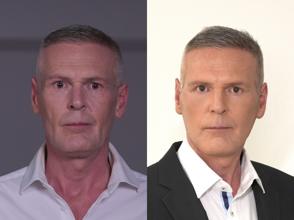 dr. Tordai István Révész Plasztika plasztikai sebészet