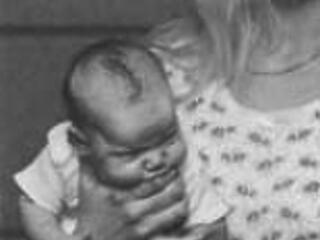 Kötelező szűrés 32-szer hosszabb ideig