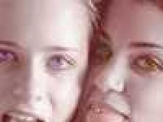 Ráncfelvarrás 17 évesen?!