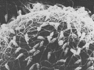 Az életmód hatása a spermaszámra