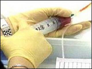 Mi a kemoterápia? Tudja Ön?