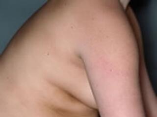 Harc az elhízás ellen