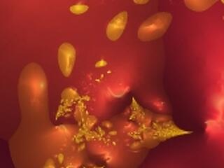 Azonnali segélyt ad a Novartis AG